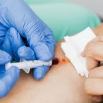 Ciągle zmęczona i blada? 9 subtelnych sygnałów anemii u kobiet, które łatwo przeoczyć